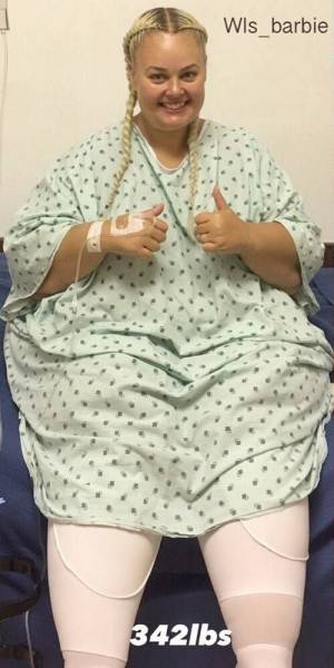 Barbie Fangirl Lost 82 Kilos To Look More Like Her Idol