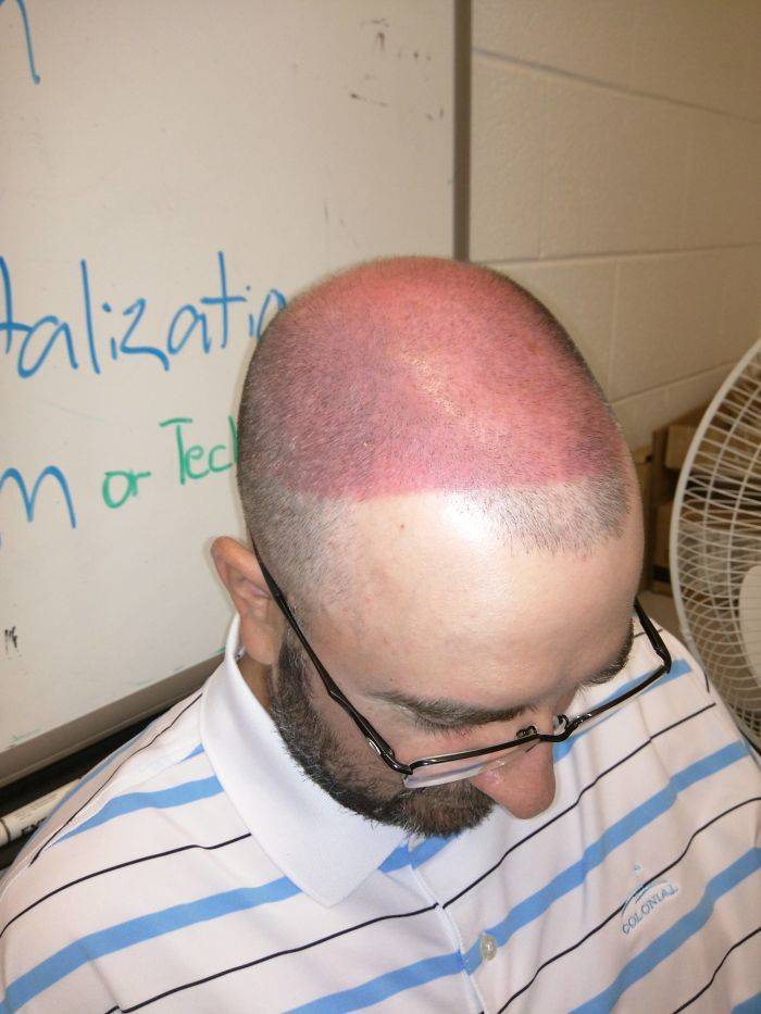 Never Forget Sunscreen!