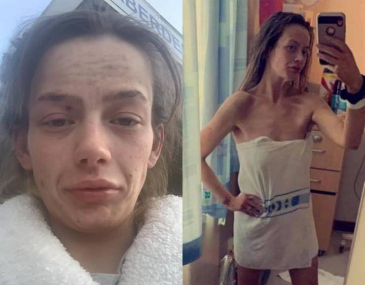 Former Heroin Addict Shares Photos Of Her Incredible Transformation