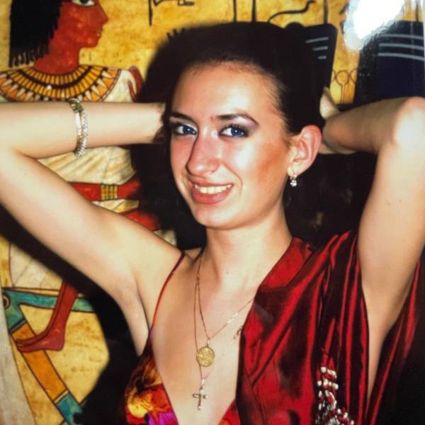 Before And After “Beauty” Fillers…