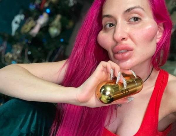 Before And After “Beauty” Fillers…