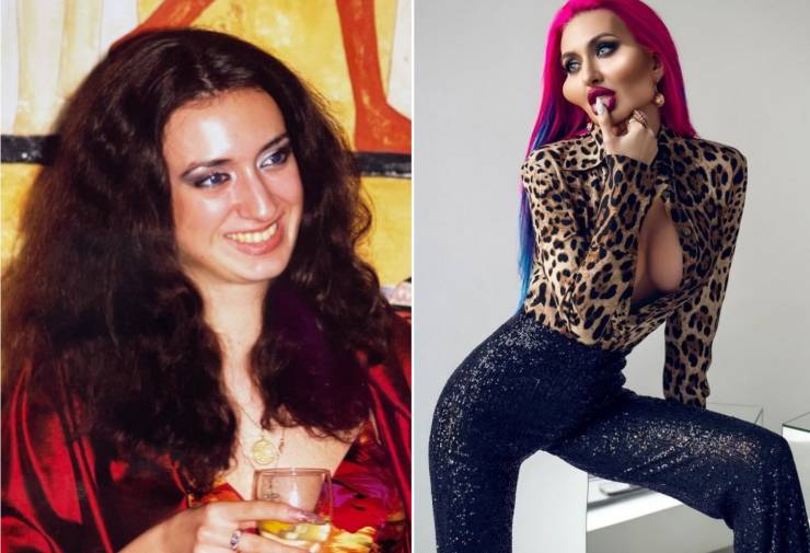 Before And After “Beauty” Fillers…