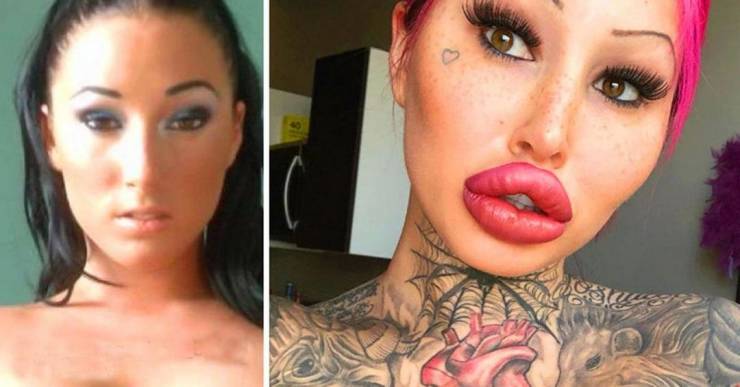 Plastic Surgery Fanatic Revealed Her Pre-Surgery Photos