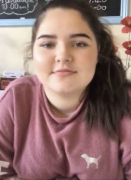 Girl Loses A Huge Amount Of Weight, Turns Into A Kylie Jenner Lookalike