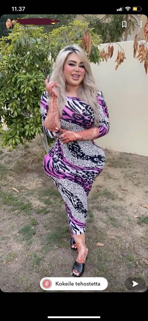 Photo Editing Is Not Healthy For These People…