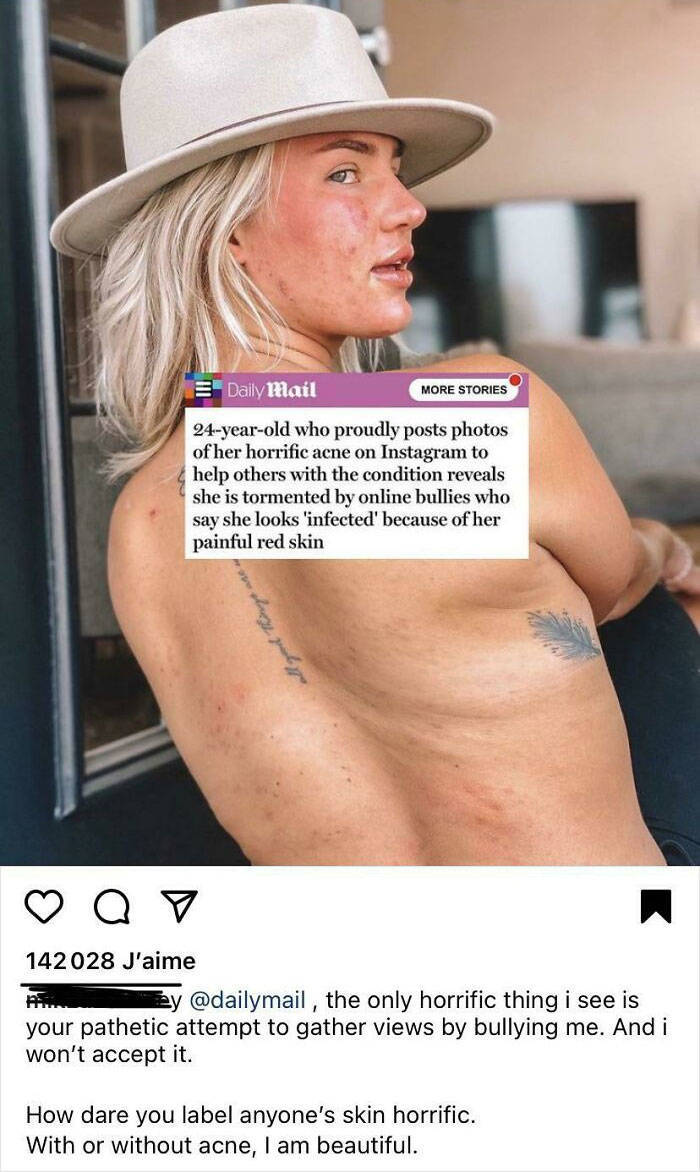 People Showing Their Real, Unedited Beauty