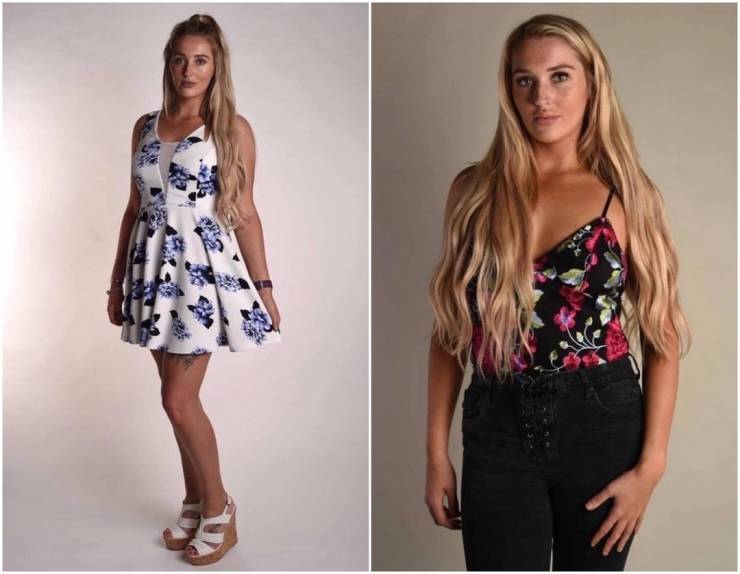 British Girl Who Spent Over $93 Thousand On Plastic Surgery Can No Longer Tie Her Own Shoelaces