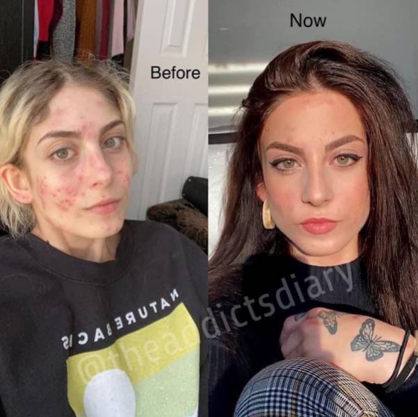 Incredibly Inspiring Drug Addict Transformations!