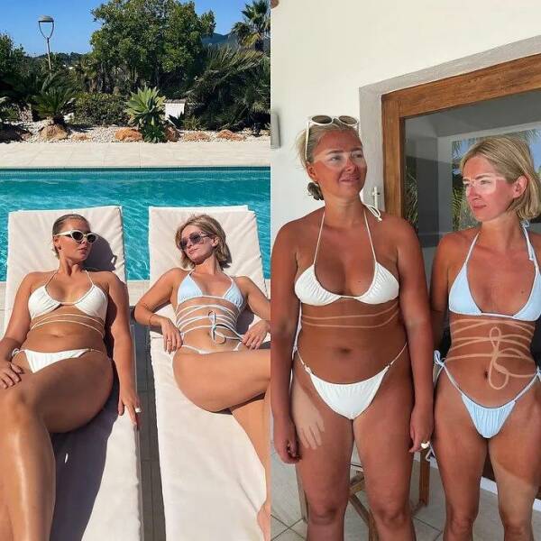 When Sunbathing Goes Wrong…