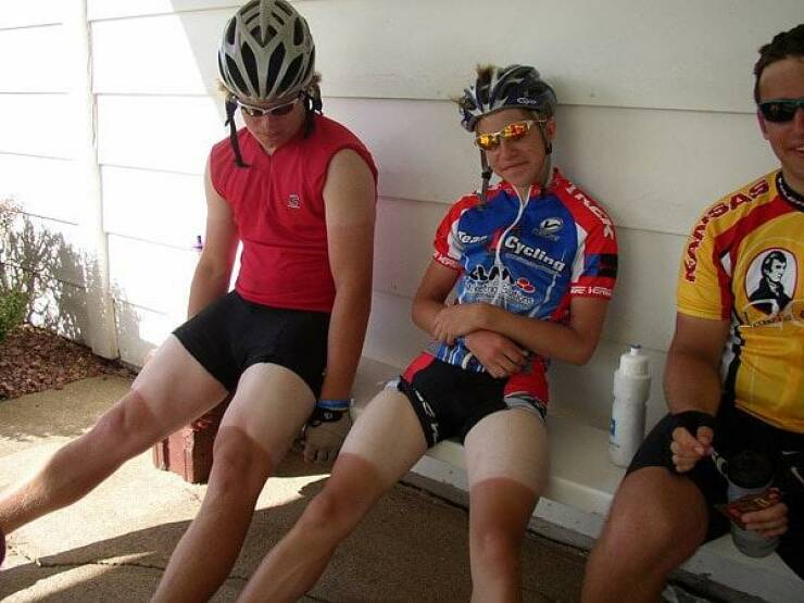 When Sunbathing Goes Wrong…