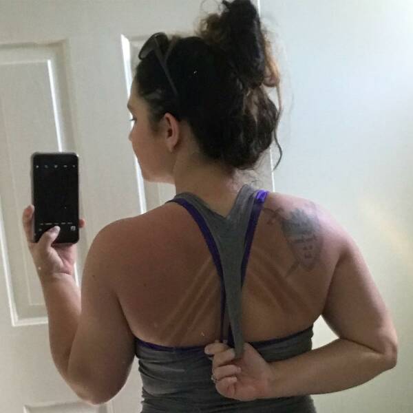 When Sunbathing Goes Wrong…