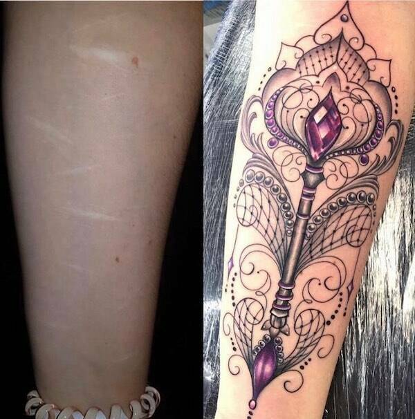 People Covering Their Scars In Cool Fashion
