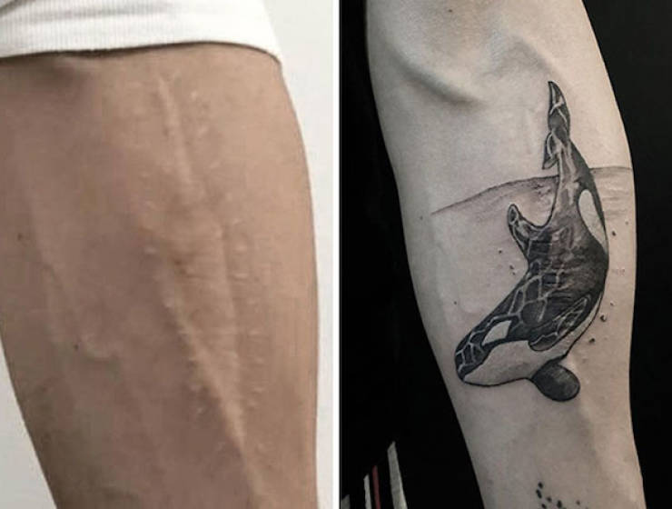 Tattoo Artists Covering Scars And Birthmarks