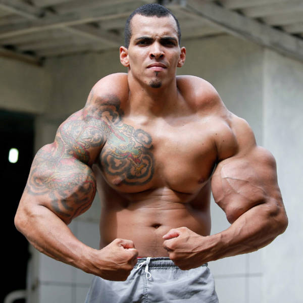 Synthol Does NOT Look Good, Guys…