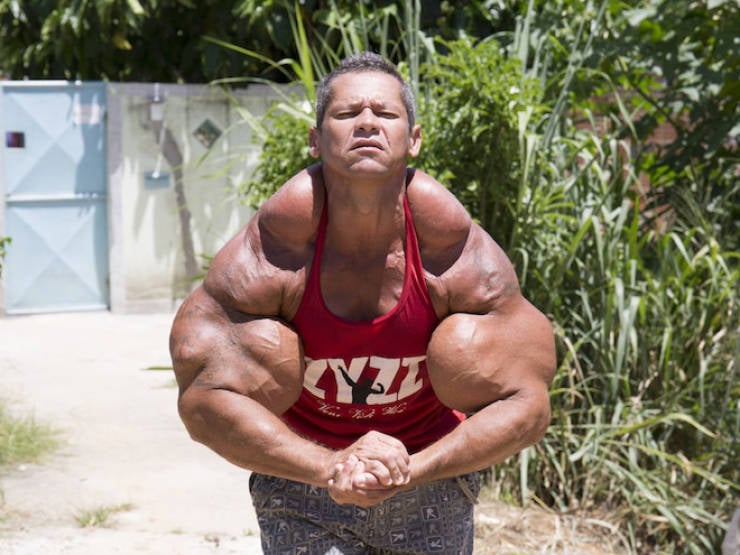 Synthol Does NOT Look Good, Guys…