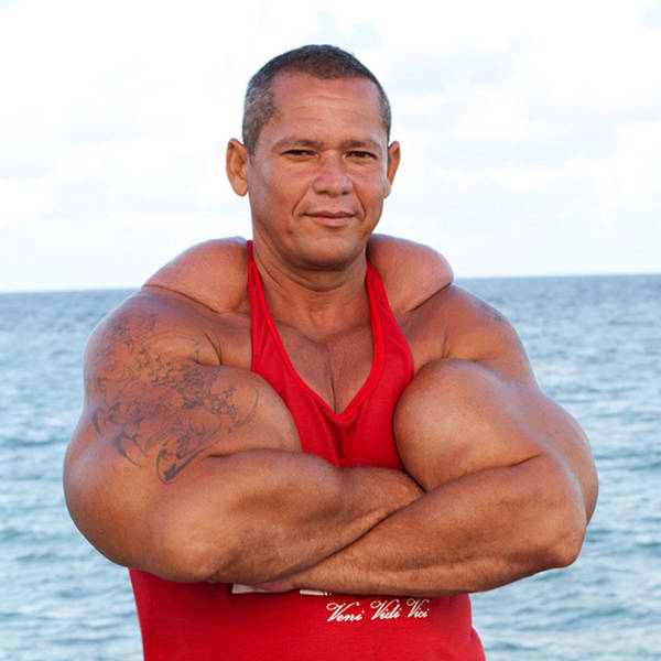 Synthol Does NOT Look Good, Guys…