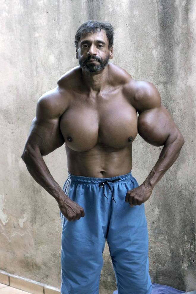 Synthol Does NOT Look Good, Guys…
