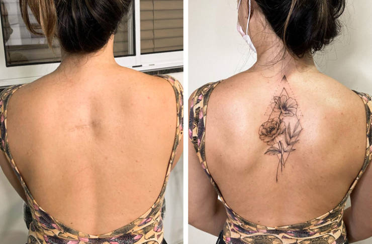 Artist Saves People’s Scars By Tattooing Over Them