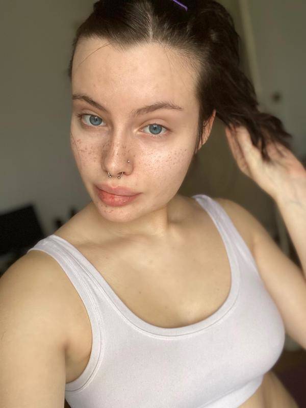 The Charm Of Freckled Faces