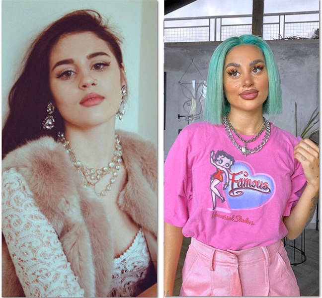 When Plastic Surgery Goes Too Far