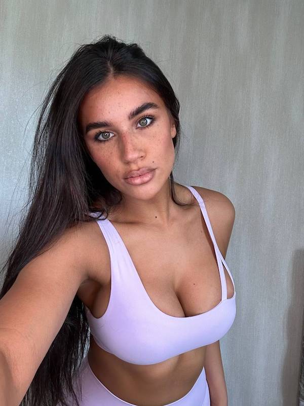 Freckle Fantasia: The Atomic Beauty Of Adorableness