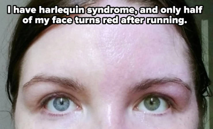 The Human Body: Strange, Fascinating, And Occasionally Creepy