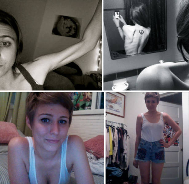 Anorexia Is Not The Final Verdict!