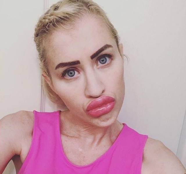 Danger! High Risk Of Silicone Explosion!