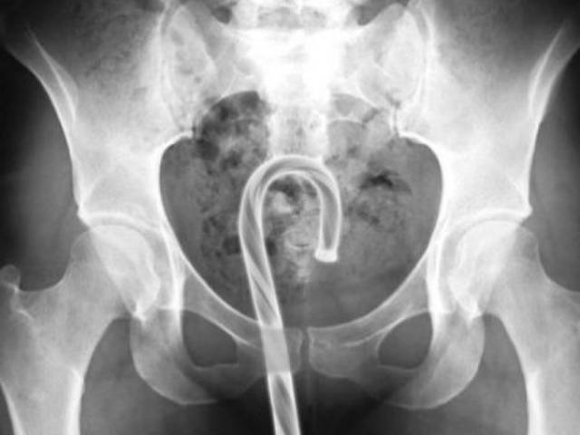 Sex Can Be A Cause Of Quite A Lot Of Injuries