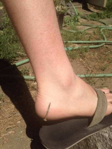 When Sh#t Is Literally Everywhere