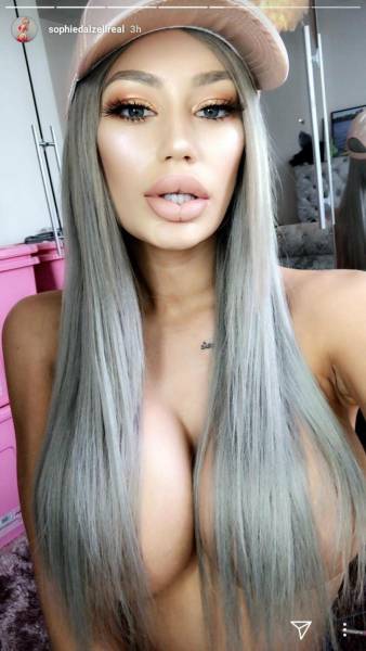 For Them, Lips Are Never Big Enough…