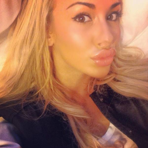 For Them, Lips Are Never Big Enough…