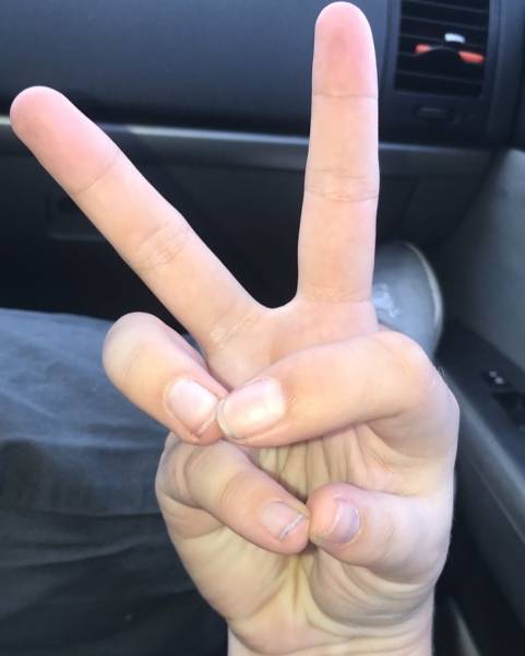 Their Bodies Are Too Weird To Be Real