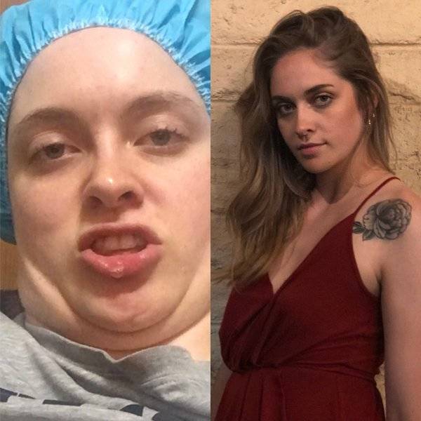 Pretties Go Derp-Mode