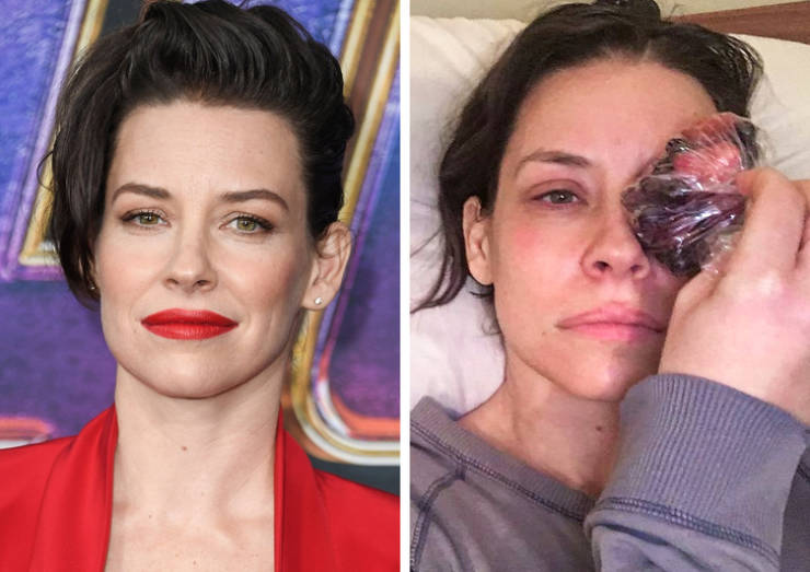 Female Celebs Who Don’t Hide What’s Under Their Makeup