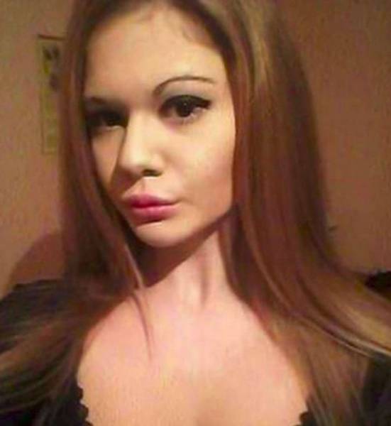 Bulgarian Girl With World’s Largest Lips Enlarged Them For The 20th Time