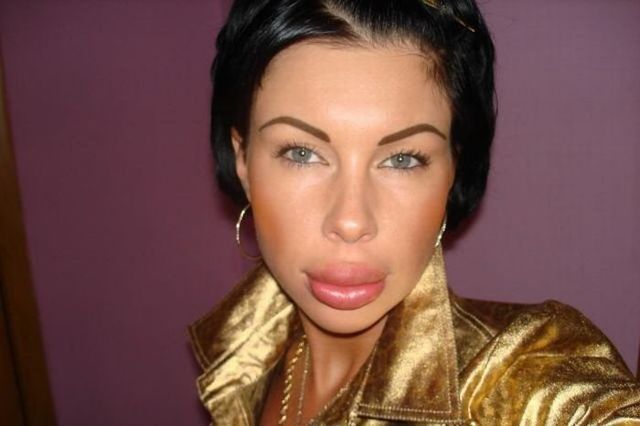 Girls with silicone faces (37 pics) Girls with silicone faces (37 pics)