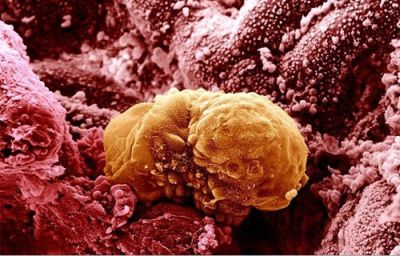 Curiosities and bonus pictures