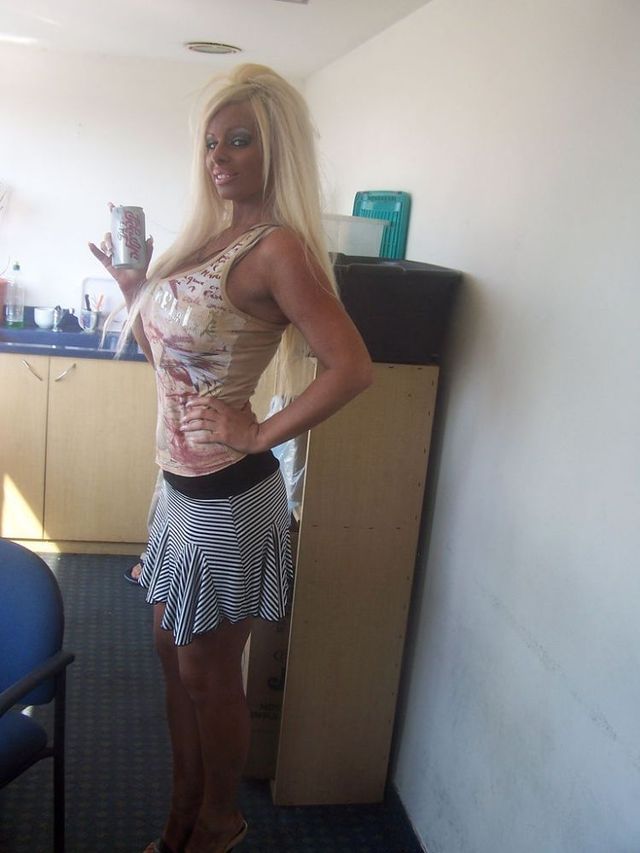 The dream of any plastic surgeon (20 pics)