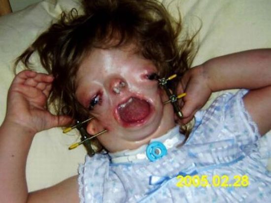 Girl Without a Face (19 pics + 1 video)