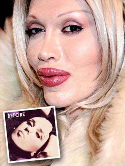 Incredible Transformation of Pete Burns (11 pics)
