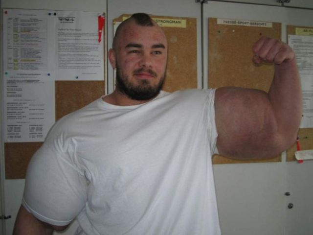 When Synthol Utilisation Goes Wrong! (53 pics)
