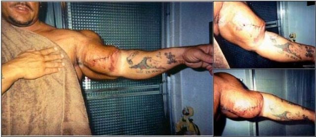 When Synthol Utilisation Goes Wrong! (53 pics)