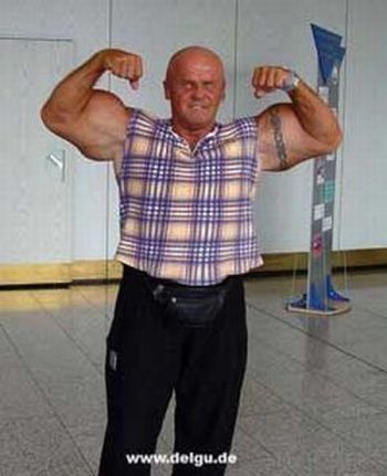 When Synthol Utilisation Goes Wrong! (53 pics)