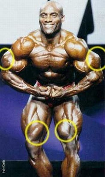 When Synthol Utilisation Goes Wrong! (53 pics)