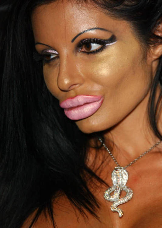 “Monster” Smile (16 pics)