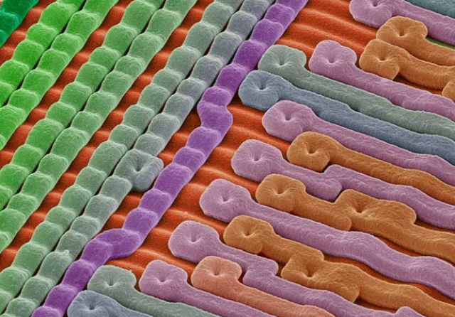 Amazing Scanning Electron Microscope Pictures