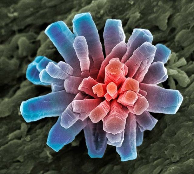 Amazing Scanning Electron Microscope Pictures
