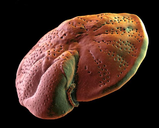 Amazing Scanning Electron Microscope Pictures