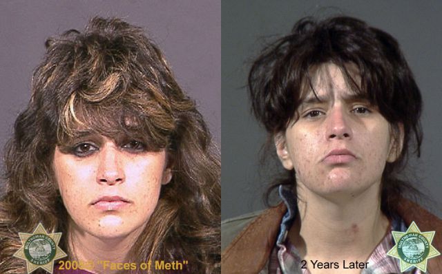 Meth Addicts: Before and After